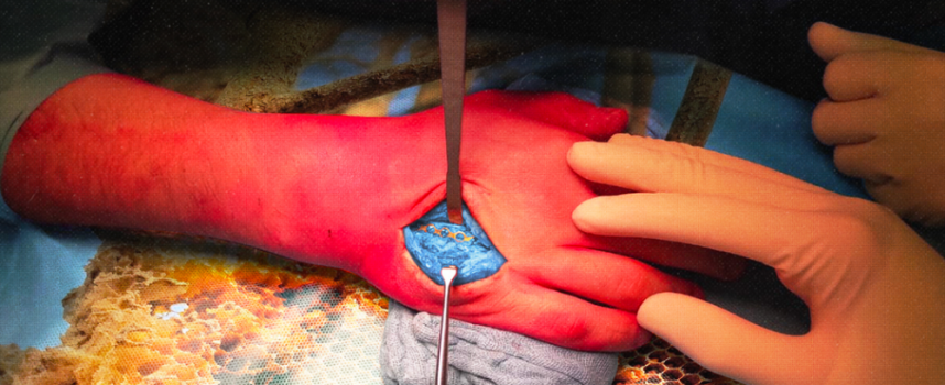 Fuori oggi “Dita cotte” il nuovo singolo di Deepho