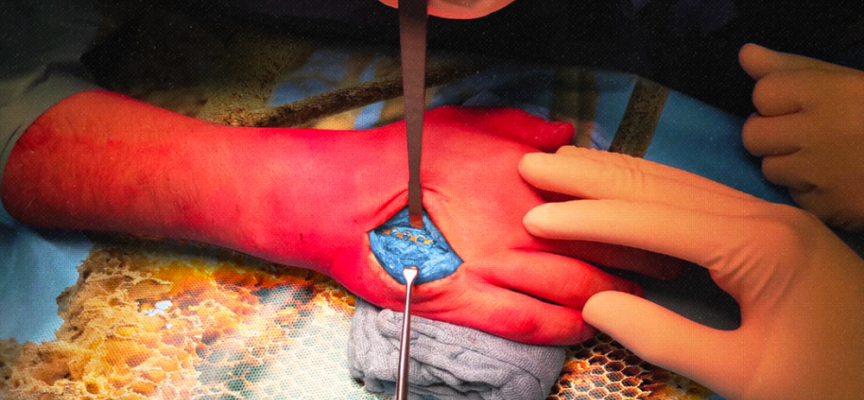 Fuori oggi “Dita cotte” il nuovo singolo di Deepho