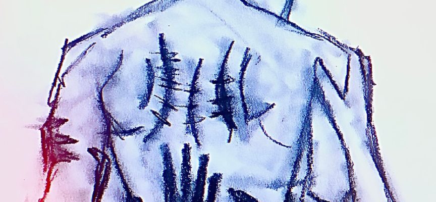 Tuono presenta il nuovo singolo “CICATRICI”